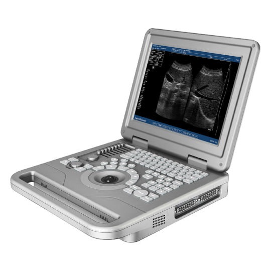 HBW-3 PlusB/W Ultrasound scanner