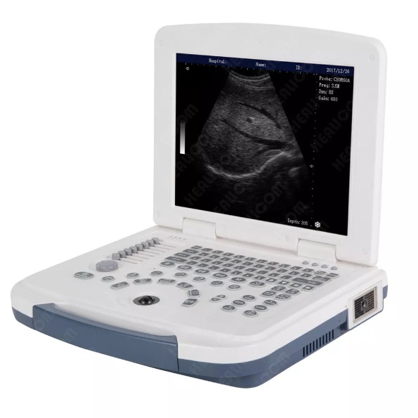 HBW-4B/W Ultrasound scanner