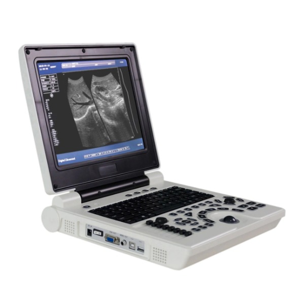 HBW-6Laptop B/W Ultrasound Scanner