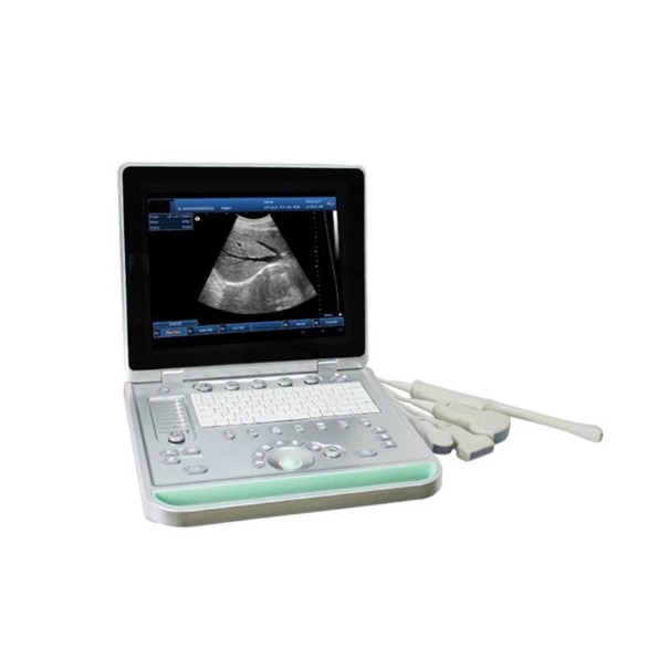 HBW-9PC based Laptop B/W Ultrasound Scanner