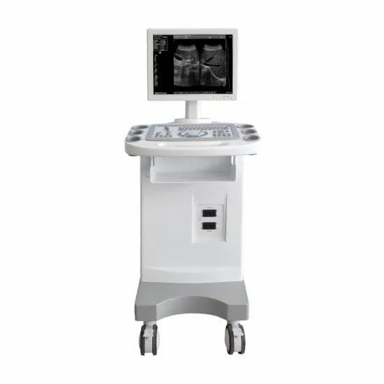 HBW-10Full-digital Trolley Ultrasound Scannerr