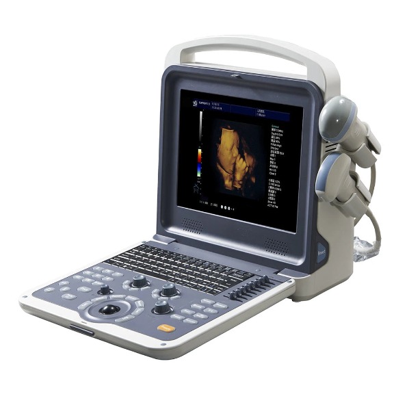 HUC-300Hand-carried 4D Color Ultrasound Diagnostic System